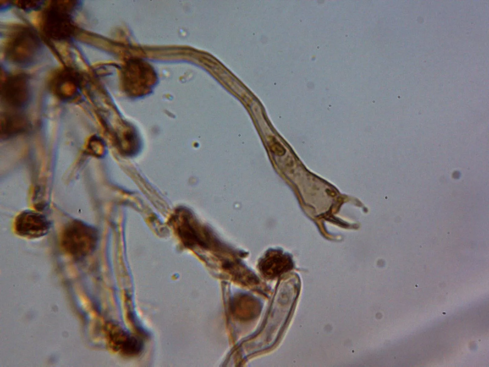 Microscopía de Odontia fibrosa - 10 - Basidio 1